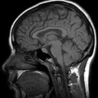 Głosy wśród zgliszczy?